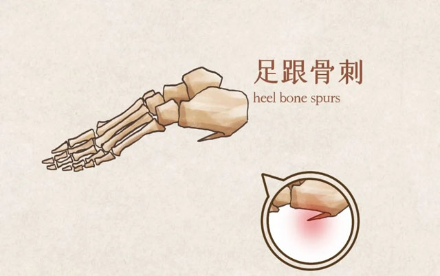 寶璣表盤破裂怎么辦?(解決寶璣表盤破裂的方法)